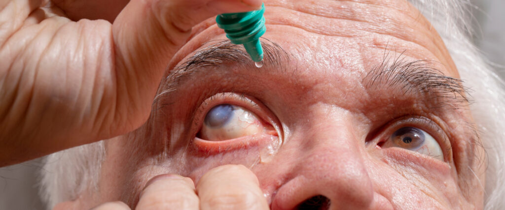 Descubre todos los tipos de glaucoma que existen.