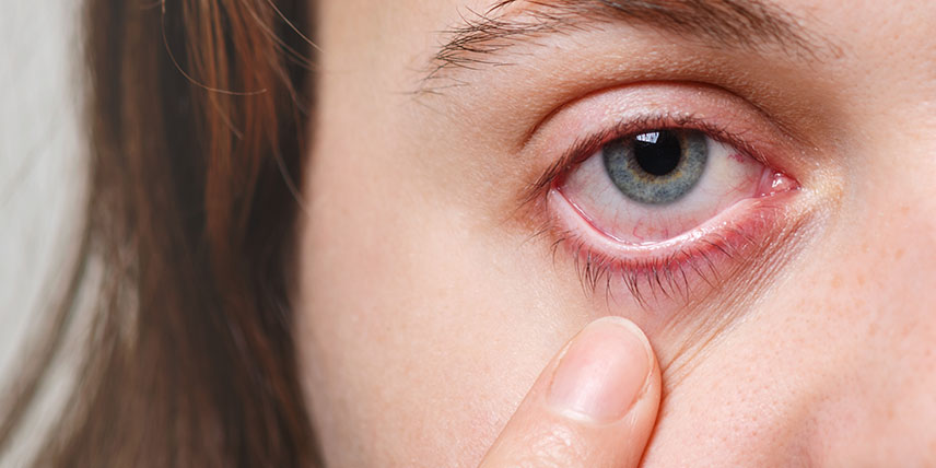 ojos-rojos