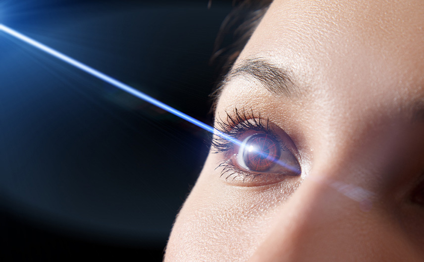 6 beneficios de la cirugía láser refractiva