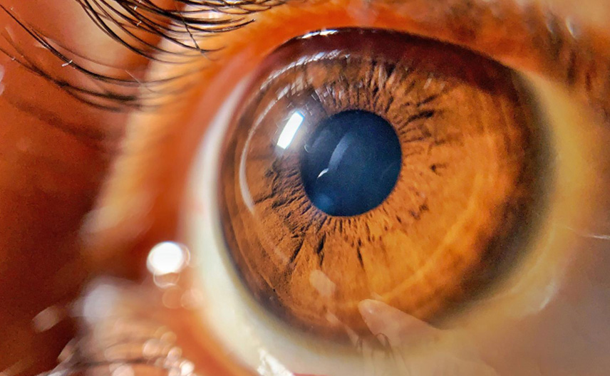 Cirugía de retina: técnicas modernas y tasas de éxito