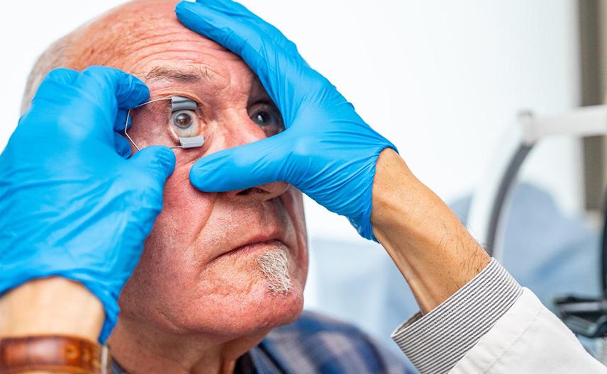 Consejos de cuidados después de una cirugía de cataratas en los ojos